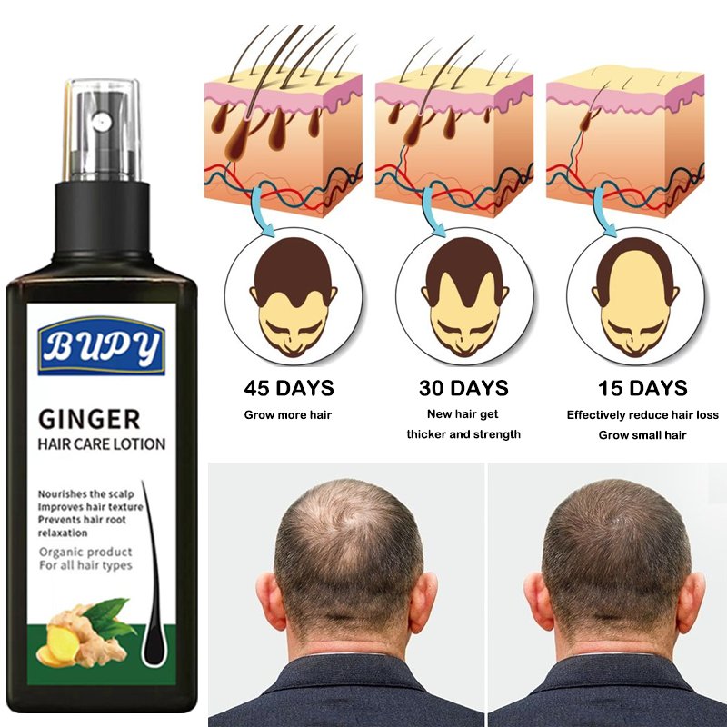 Ginger Fast Growth Spray Scalp Serum Biotin Hair Regrowth Tonics Anti Hair Loss Treatment Hair Lotion Spray For Men