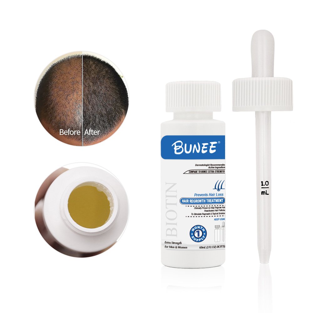 Anti loss serum hair growth oil hair loss treatment products organic herbal biotin tonic