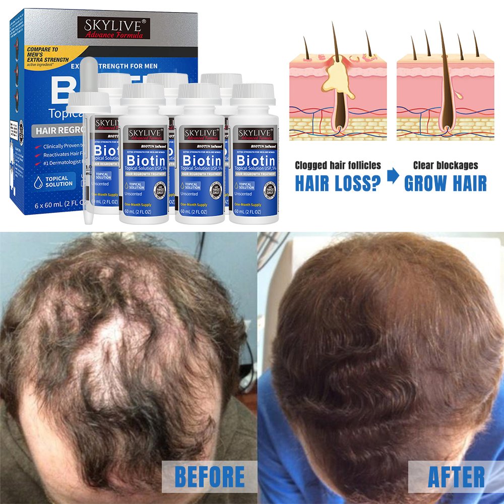 New Design 5% Kirland Hair Regrowth Fast Growing Repair Treatment Hair Treatment Organic Biotina Hair Growth Serum Oil