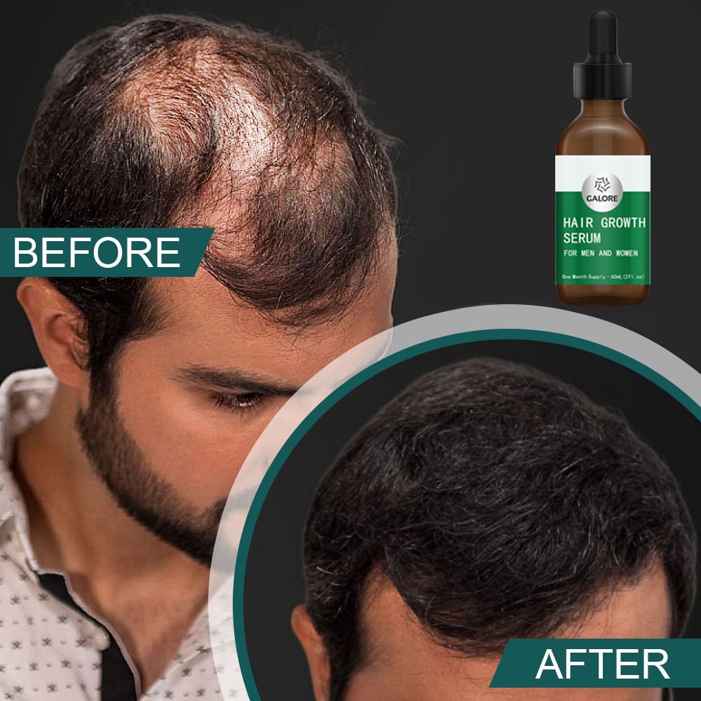 Private Label 100% Organic Hair Growth Oil For Loss Hair Sulphate Free Natural Hair Care Shampoo