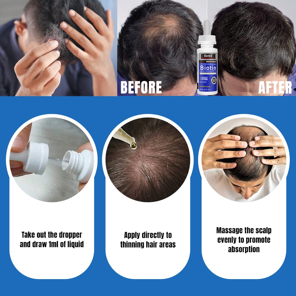 BUNEE Hair Regrowth Tonics Serum Growth Hair Treatment Natural Tea Tree Essence Best Hair Growth Serum