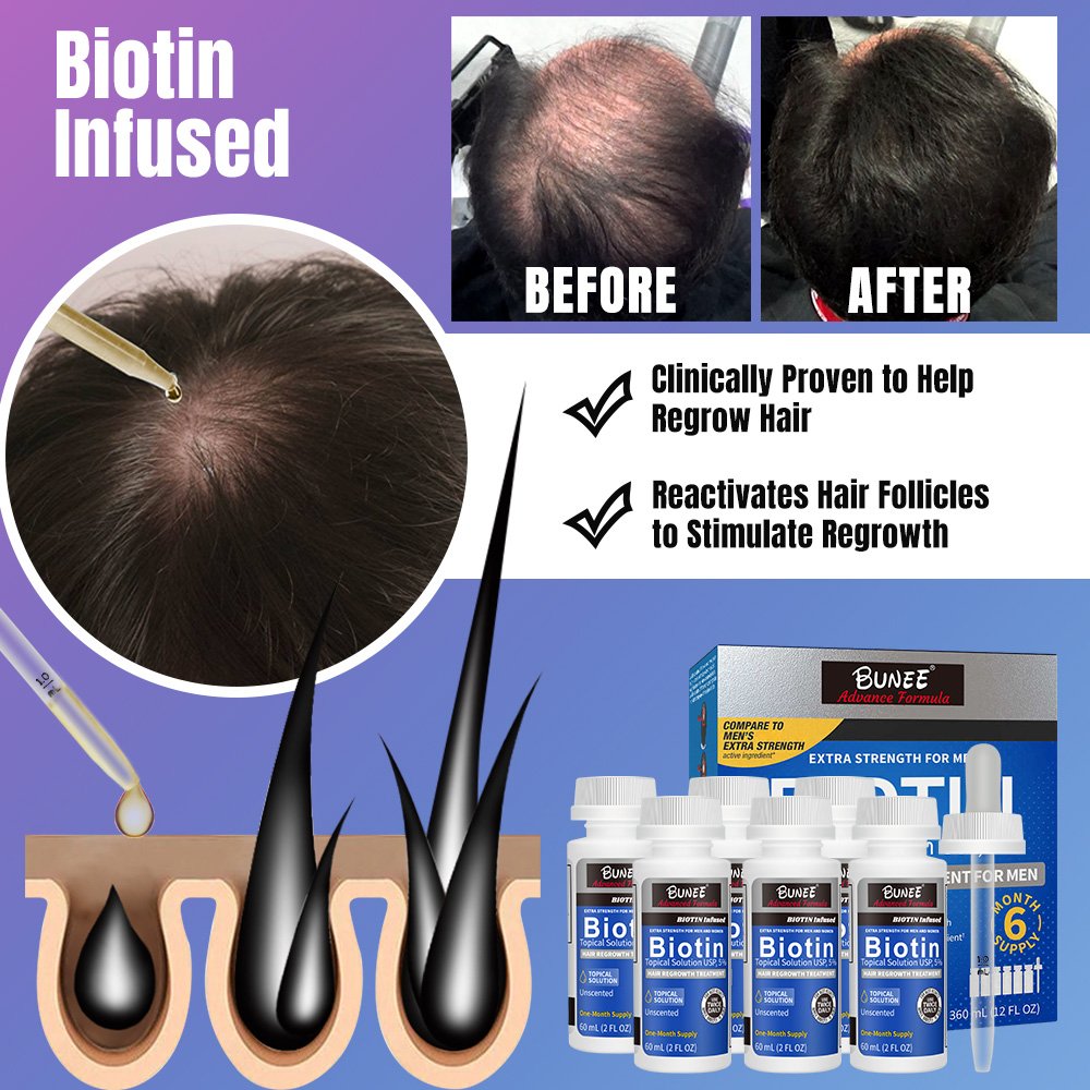BUNEE Hair Regrowth Tonics Serum Growth Hair Treatment Natural Tea Tree Essence Best Hair Growth Serum