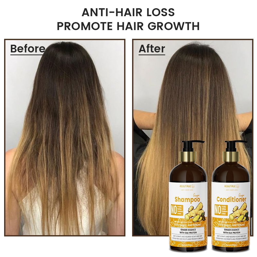 Factory Wholesale Custom Vegan Organic 500ml Anti Hair Loss Dandruff Ginger Shampoo And Conditioner For Hair Growth Shampoo