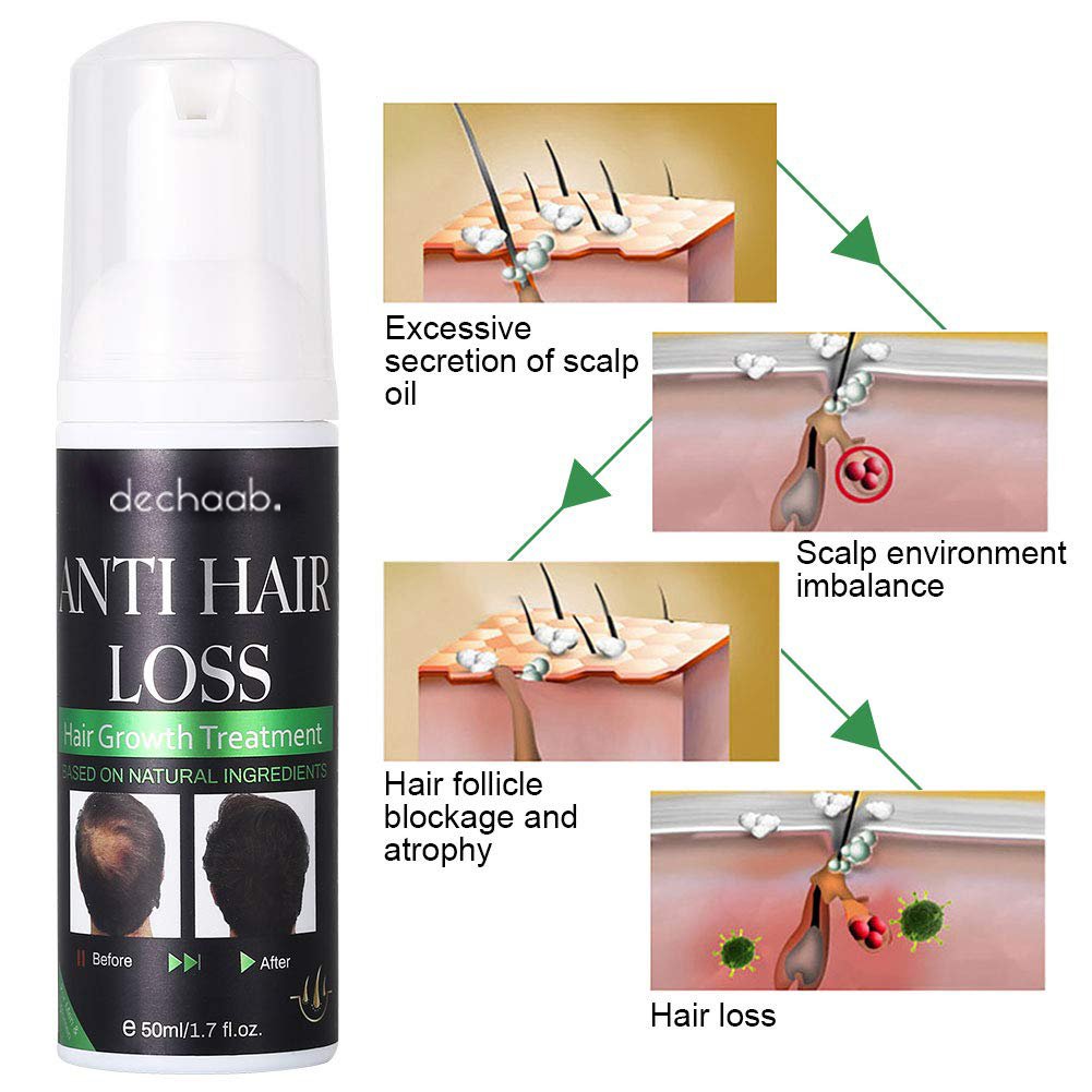 Private Label Hair Loss Hair Growth Foam Treatment For Men