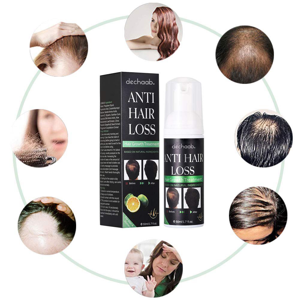 Private Label Hair Loss Hair Growth Foam Treatment For Men
