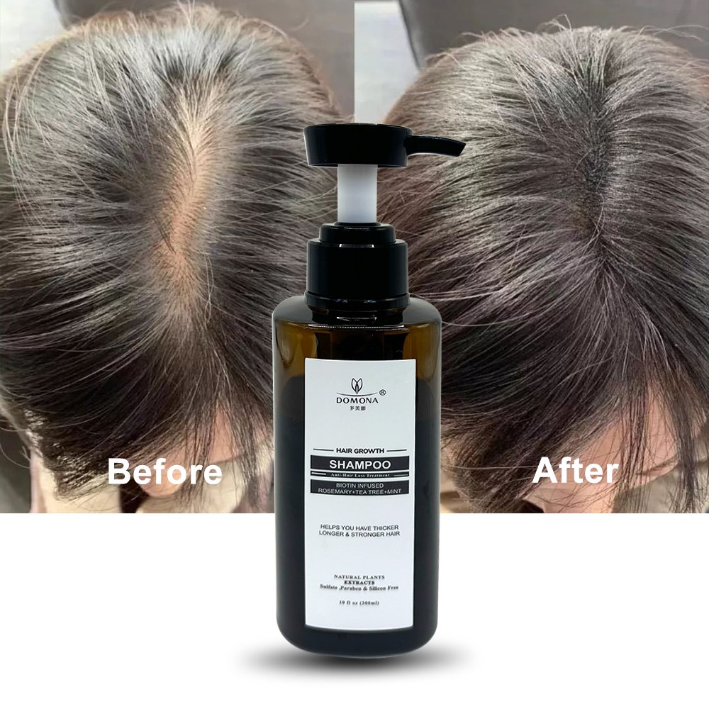 Hot Selling Product Advanced Hair Growth Shampoo With Natural Ingredients For Promoting Fuller And Thicker Hair