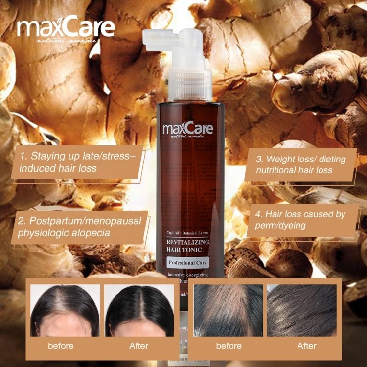 Organic Ginger Hair Tonic Serum Herbal Anti-Hair Loss Solution for Scalp Health and Hair Regrowth