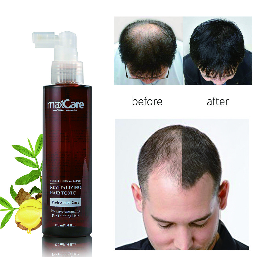 Organic Ginger Hair Tonic Serum Herbal Anti-Hair Loss Solution for Scalp Health and Hair Regrowth