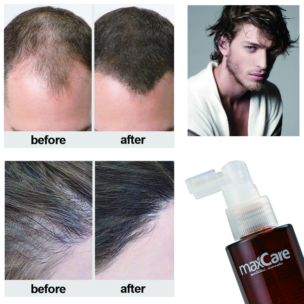 Organic Ginger Hair Tonic Serum Herbal Anti-Hair Loss Solution for Scalp Health and Hair Regrowth