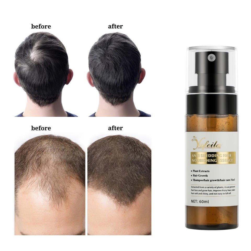 OEM Wholesale Biotin Hair Oil Manufacturers Caffeine Fast Hair Growth Oil Private Label Hair Regrowth Serum