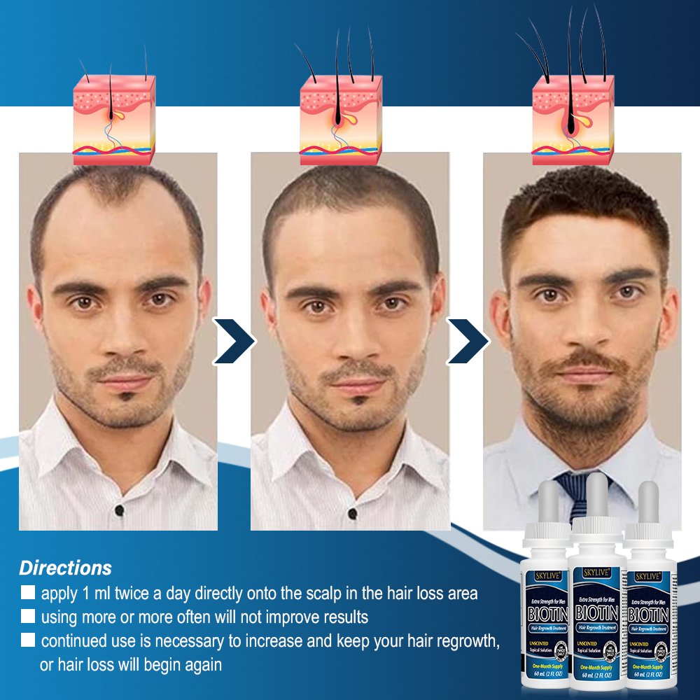 High Quality Chinese Herbal Extracts Naturally Hair Care Hair Growth tonic