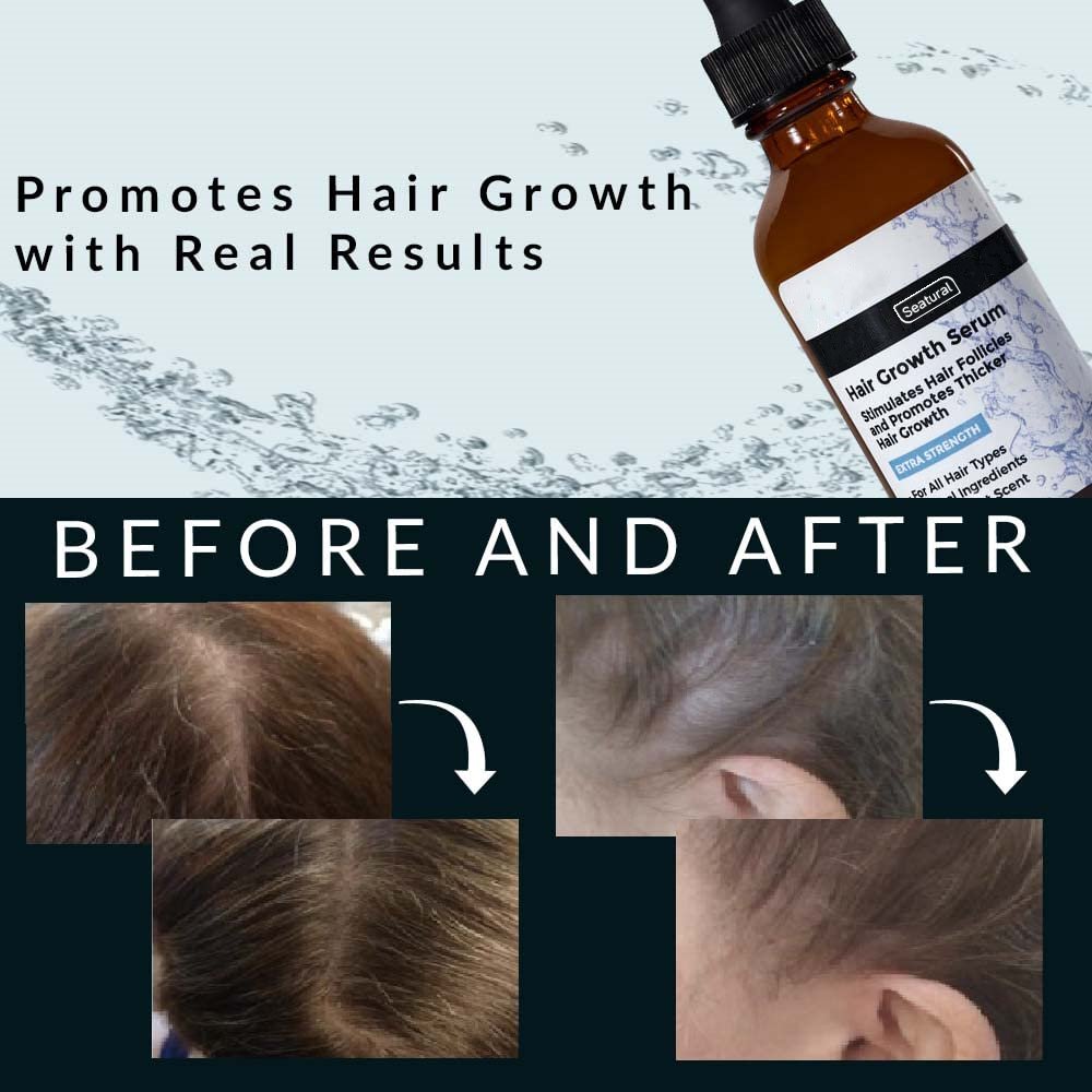 Private Label Organic Biotin Anti Hair Loss Hair growth Serum Improve Hair Density, Thickness, & Fullness Regrowth