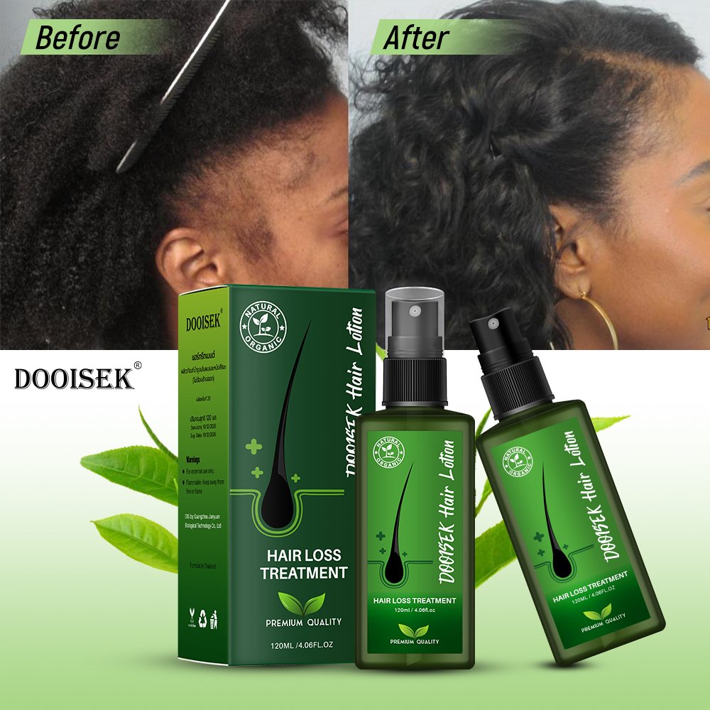 Fast Result Dooisek/Custom Logo Hair Growth Regrowth Treatment Biotin Herbal Hair Tonic Anti-Hair Loss growth serum oil