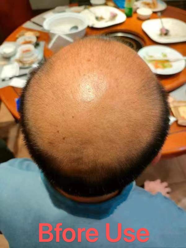 Wholesale Anti Hair Loss Promote Hair Growth Herbal Oil Repairs Damaged Hair Moisturizing Scalp Serum Shampoo And Conditioner