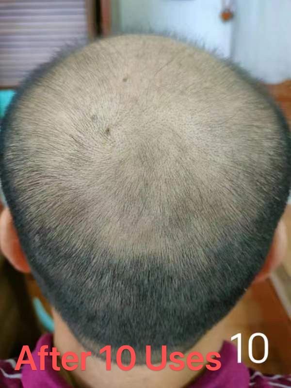 Wholesale Anti Hair Loss Promote Hair Growth Herbal Oil Repairs Damaged Hair Moisturizing Scalp Serum Shampoo And Conditioner