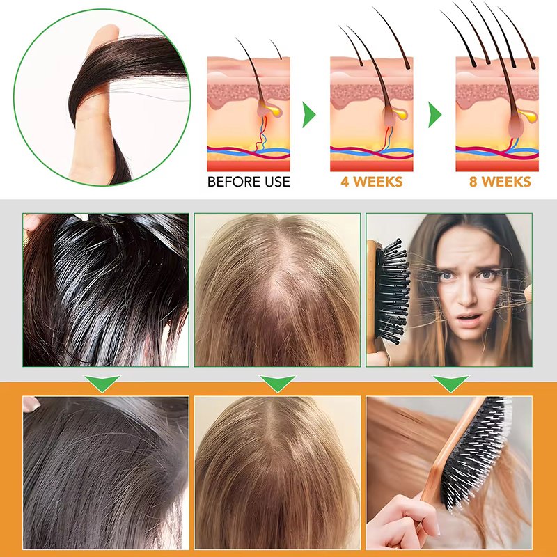 Custom Private Label Hair Care Anti Dandruff Keratin Repair Organic Tea Tree Oil Shampoo And Conditioner For Men Oily Hair
