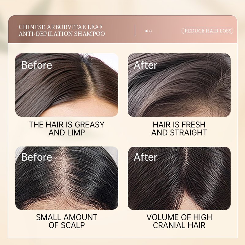 Manufacturer Oem Customized 500ml Moisturizing Ginger Extracts Anti Hair Loss Shampoo For Hair Care Strong