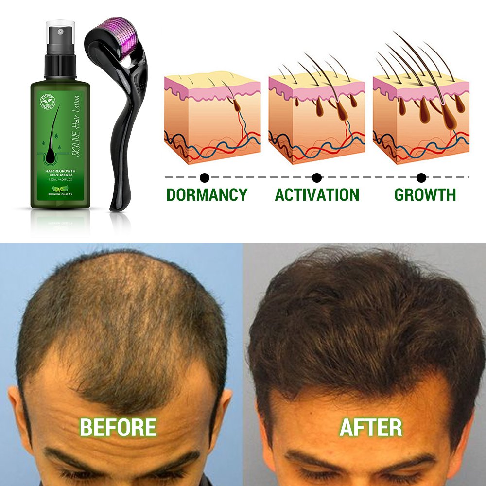 New Arrivals Organic 120ml Thailand Original Hair Lotion For Hair Regrowth Anti Hair Loss Serum Spray aceite de coco