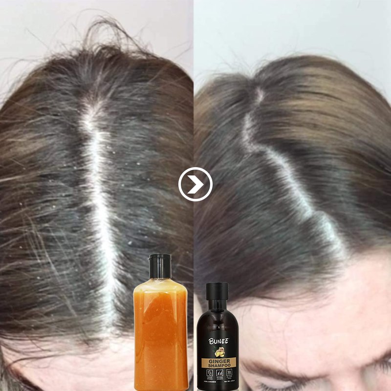Hair Regrowth Old Ginger Biotin Scalp Care Shampoo