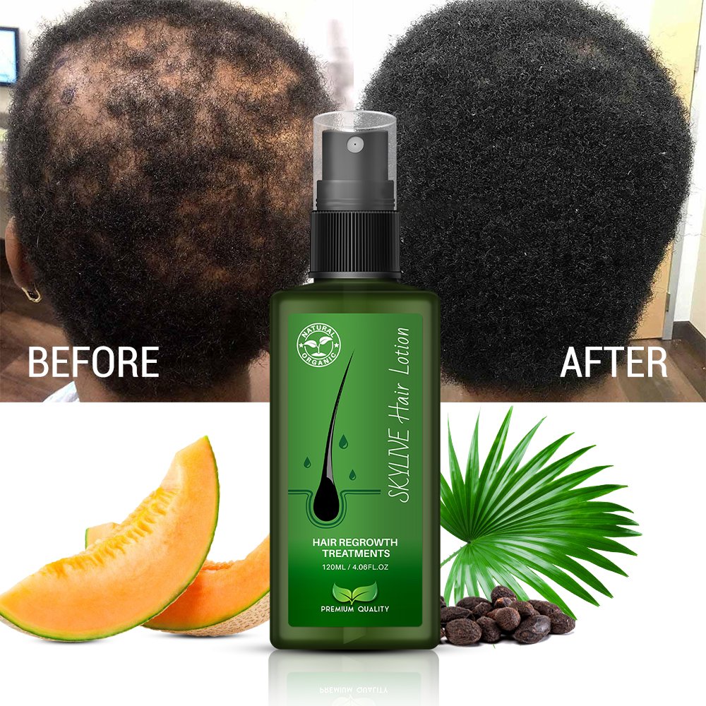 New Product hair growth serum Hair Lotion thailand Genuine from bangkok original huile de coco Hair Loss Treatment