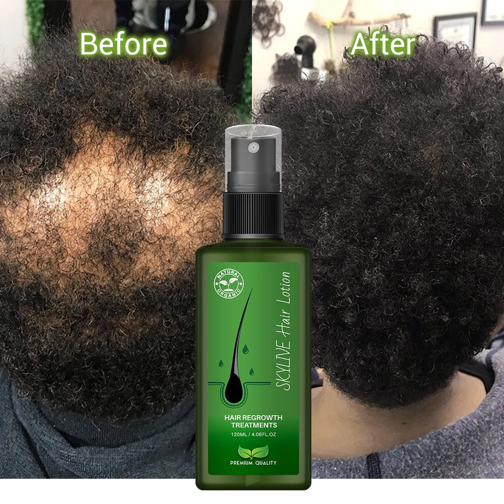 New Product hair growth serum Hair Lotion thailand Genuine from bangkok original huile de coco Hair Loss Treatment