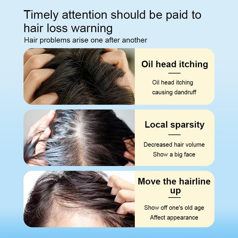 Plant Essences ginger shampoo coconut oil shampoing Anti-hair loss herbaceous aroma Shampoo