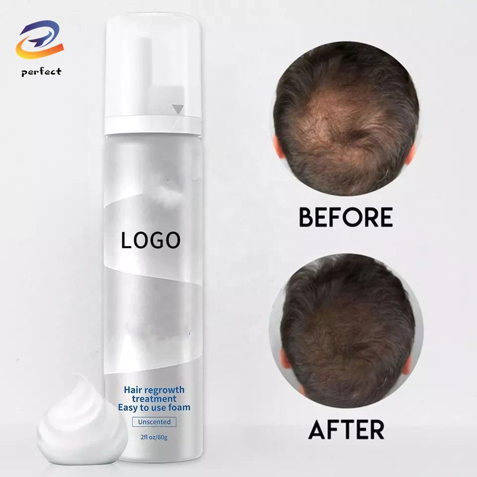 OEM Private Label Hair Growth foam 60ml kirkland foam 5% Hair Growth Oil