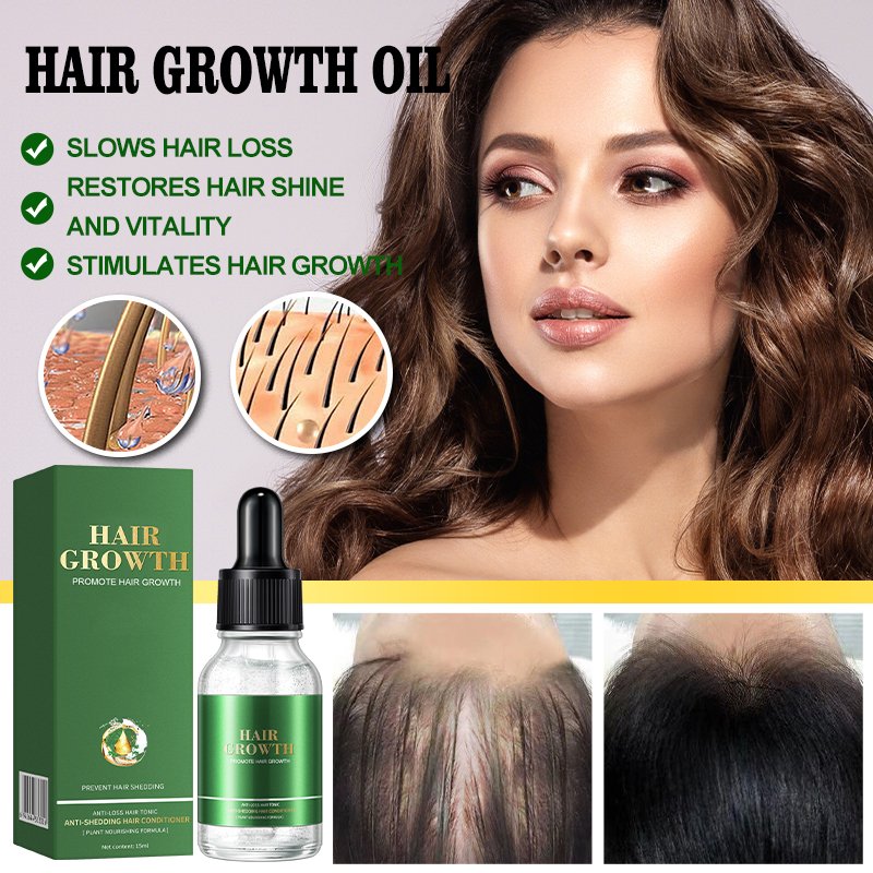 Private Label hair regrowth treatments for Rosemary Nourishing Scalp Elixirs Hair Care Loss Treatment Hair Growth Oil Serum