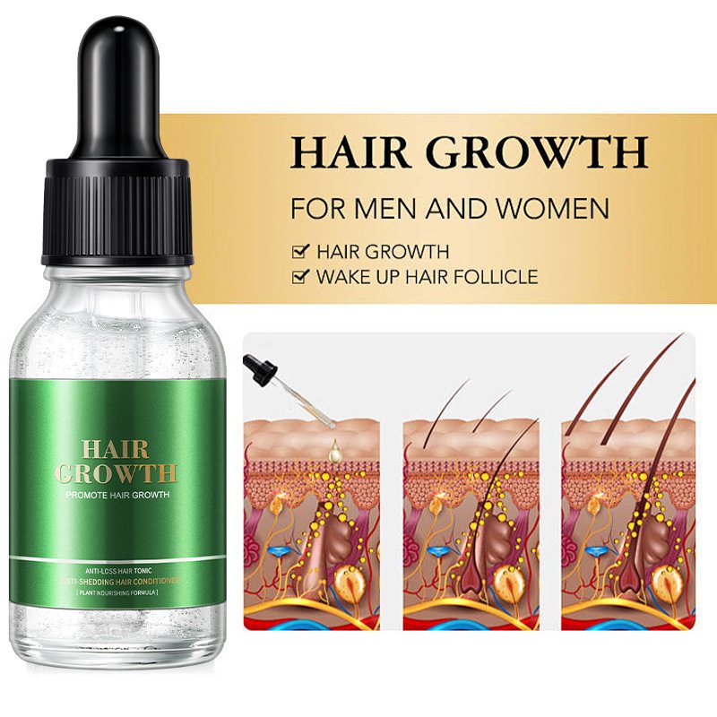 Private Label hair regrowth treatments for Rosemary Nourishing Scalp Elixirs Hair Care Loss Treatment Hair Growth Oil Serum