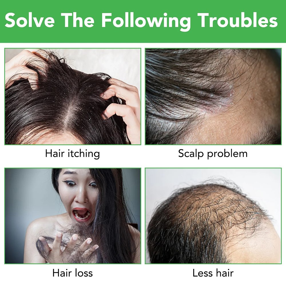Ginger hair Shampoo and Conditioner for Deep Cleansing Dandruff Frizz Smooth Hair