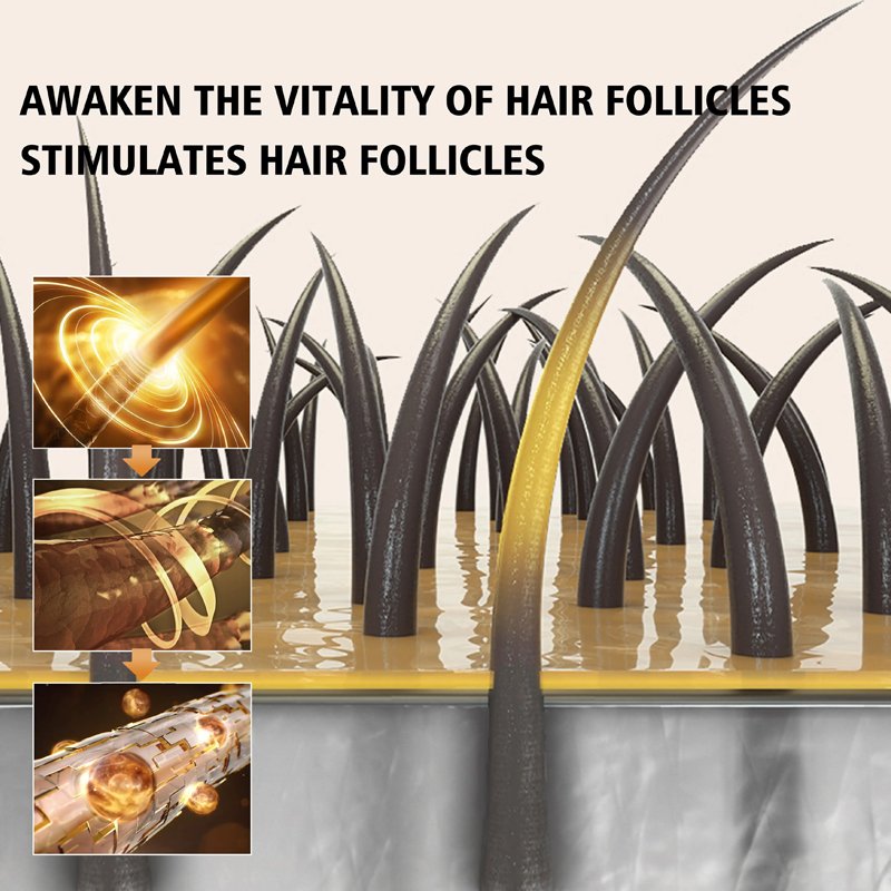 China Factory Custom Private Label Hair Care Professional Hair Growth Repair Anti Dandruff Shampoo