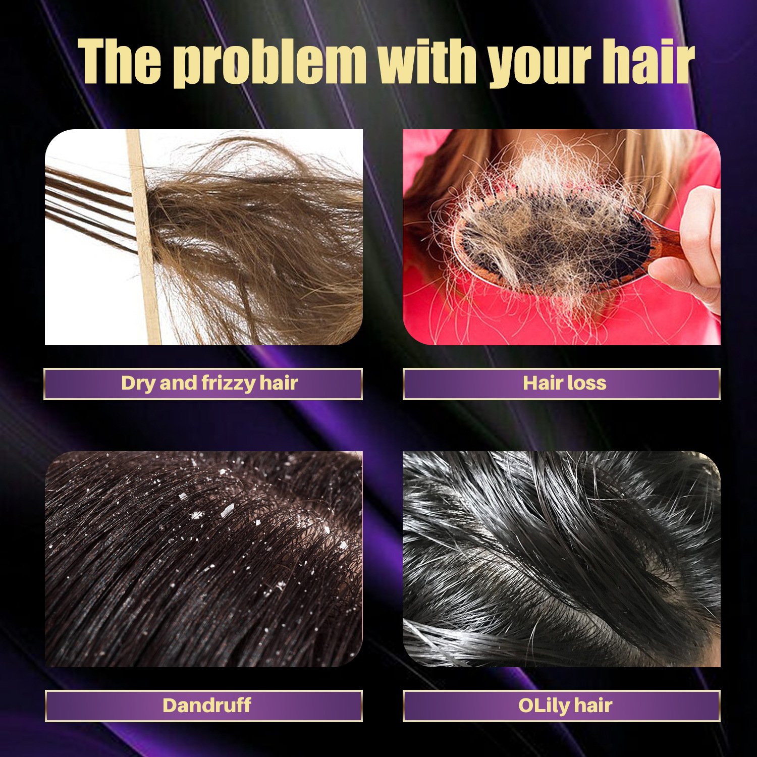 onion shampoo for hair growth rosemary and onion shampoo Private Label Organic Red Onion Anti Hair Loss Strengthens Growth