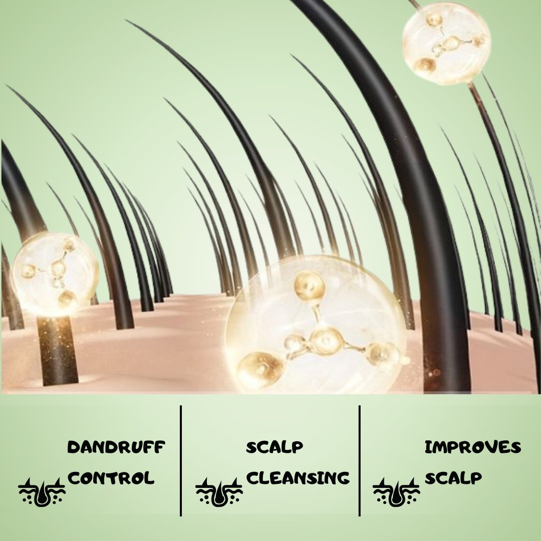 Best anti-dandruff itch shampoo for all kind of hair type,after wash scalp no dry