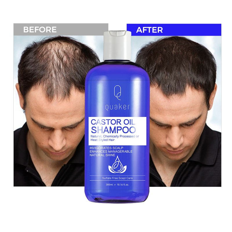 Qquaker Black Jamaican Castor Oil Sulfate Free Nature Organic Shampoo And Conditioner Set Custom Private Label