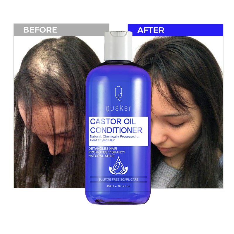 Qquaker Black Jamaican Castor Oil Sulfate Free Nature Organic Shampoo And Conditioner Set Custom Private Label