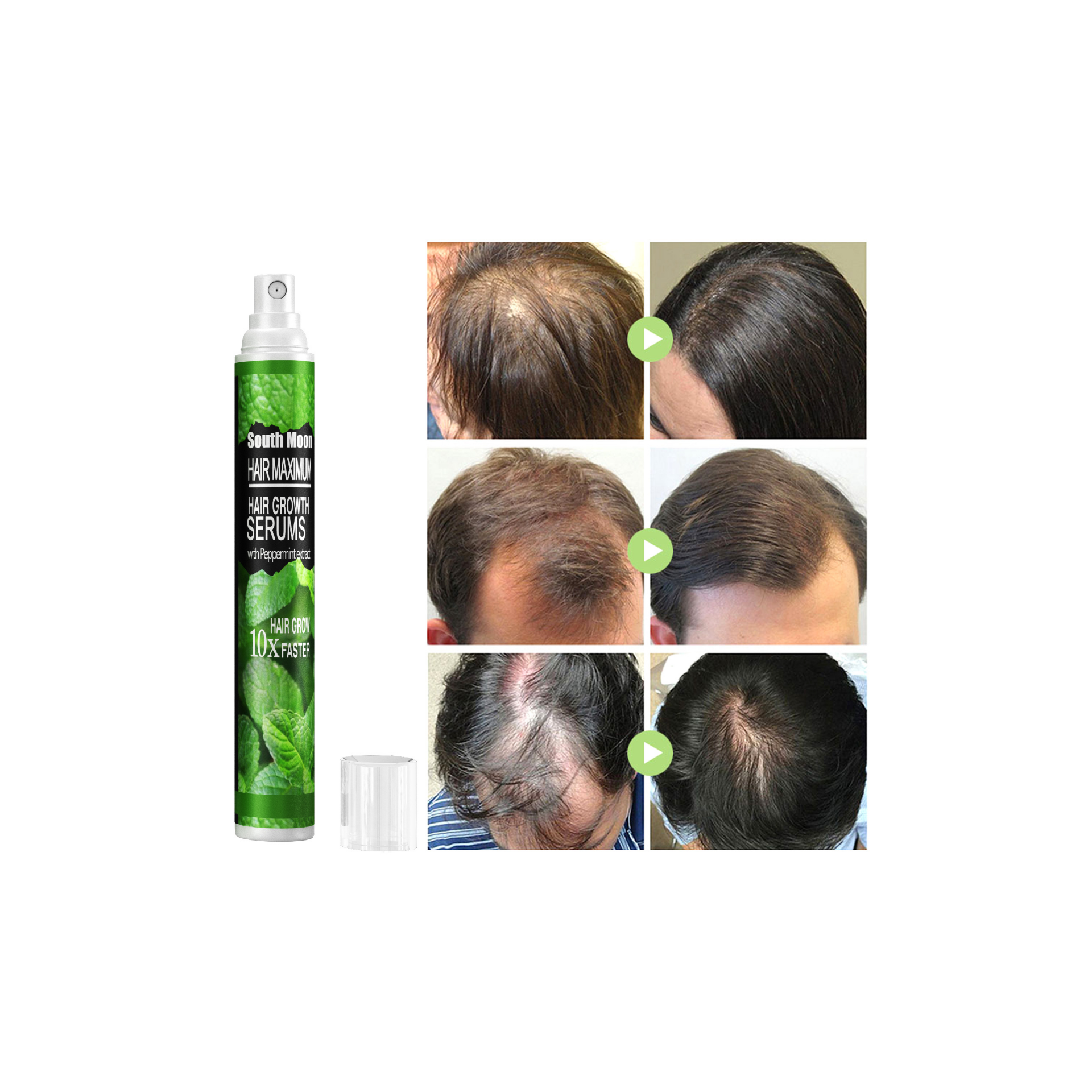 100% Herb Wholesale Mint Leaf Hair Growth Serum Spray Instant Hair Regrowth Anti Loss Care Hair Treatment Germinal Oil Spray
