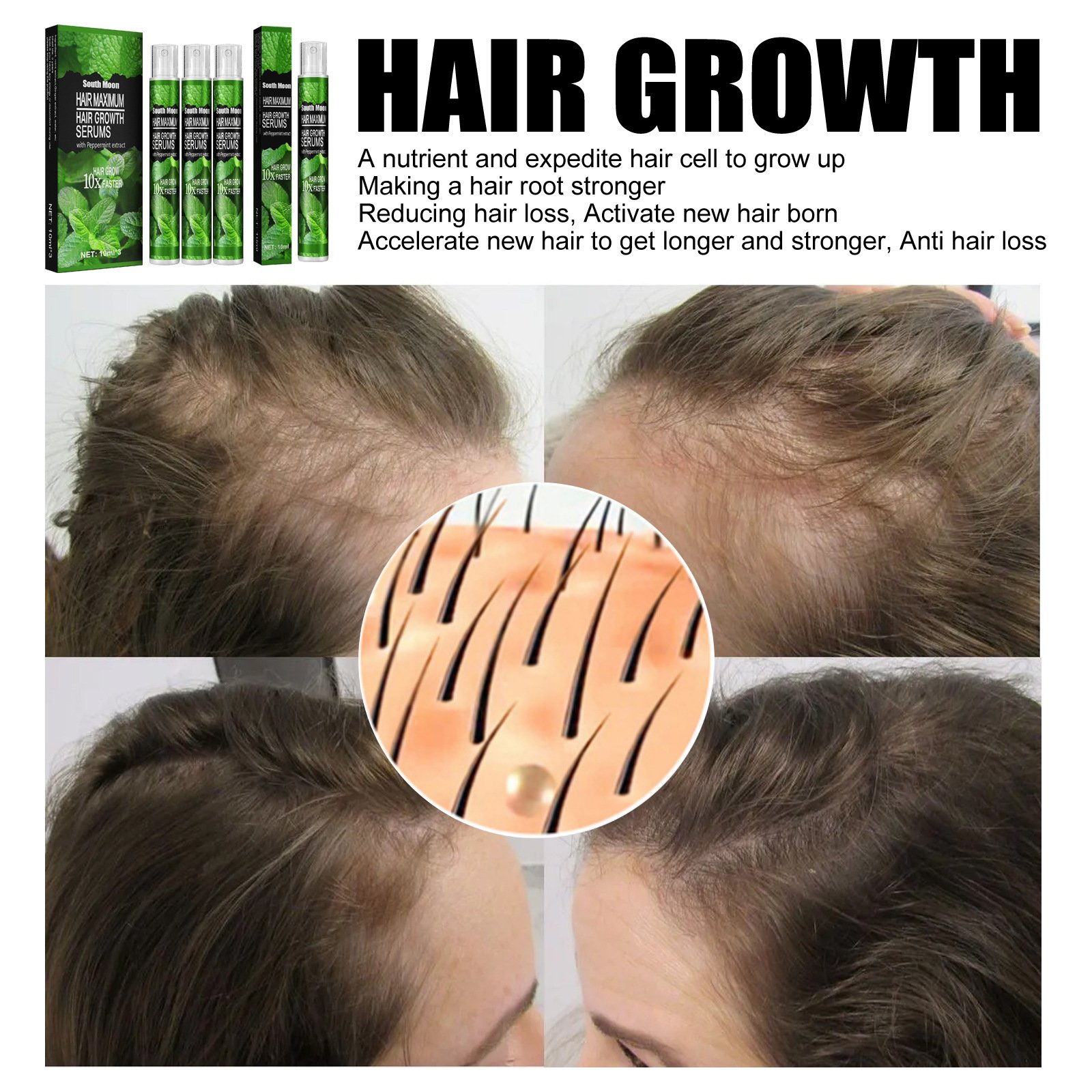 100% Herb Wholesale Mint Leaf Hair Growth Serum Spray Instant Hair Regrowth Anti Loss Care Hair Treatment Germinal Oil Spray
