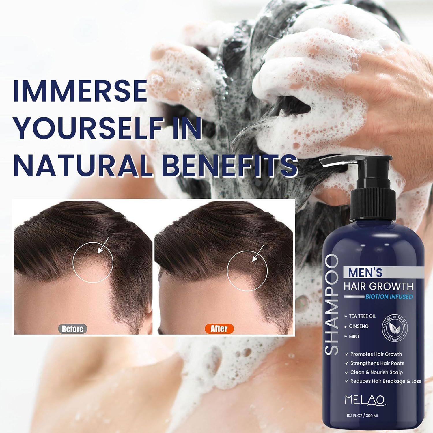 Private Label Vegan Hair Care Loss Shampoo Regrowth Thinning Hair Thickening Biotin Hair Growth Shampoo For Men