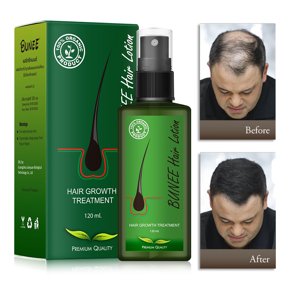 Hair Regrowth Treatment Serum Thailand Hair Regrowth Tonics Scalp Serum Strengthening Hair Growth Lotion Spray