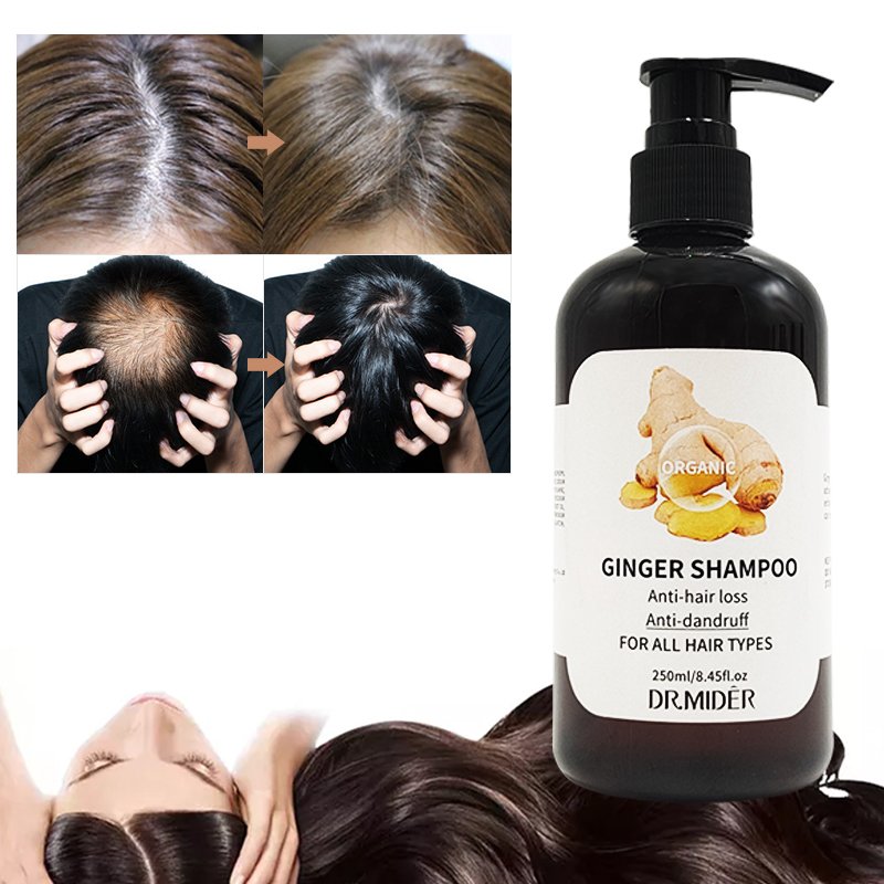Herbal Organic Hair Care Ginger Regenerating Shampoo anti-itching Treatment Anti hair loss Ginger Shampoo