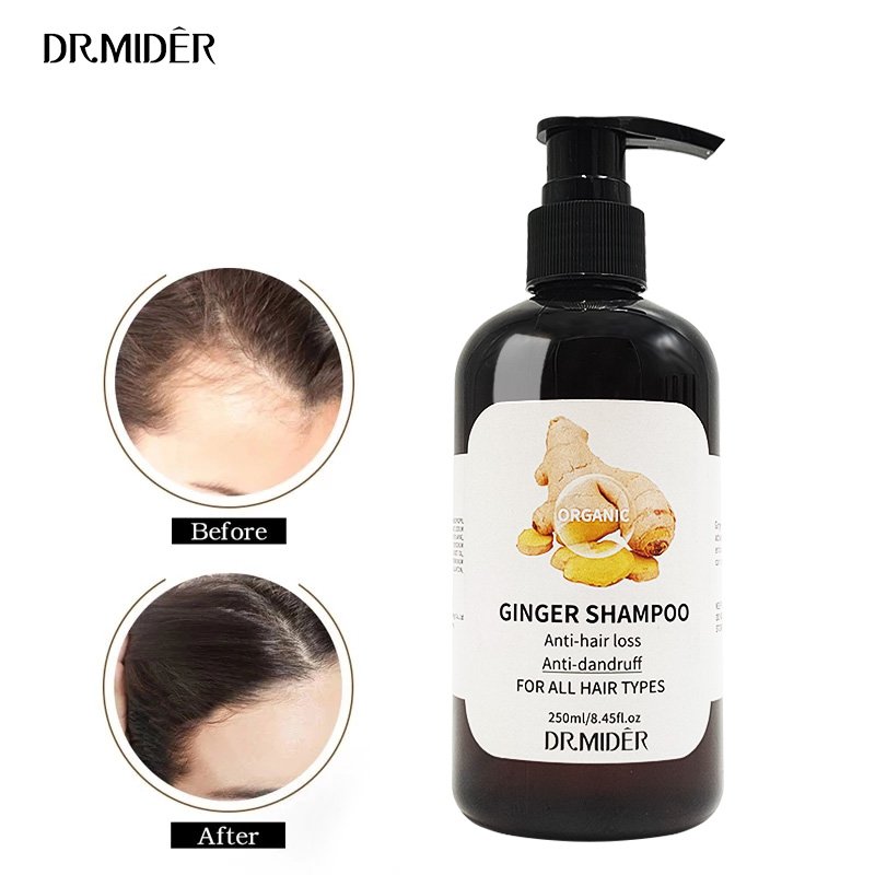 Herbal Organic Hair Care Ginger Regenerating Shampoo anti-itching Treatment Anti hair loss Ginger Shampoo
