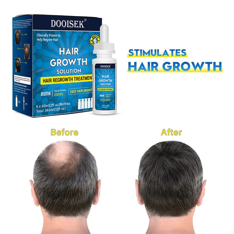 Fast Hair Growth Product Hair Growth Serum Tonic 60ml DOOISEK 5% Hair Growth Oil with dropper