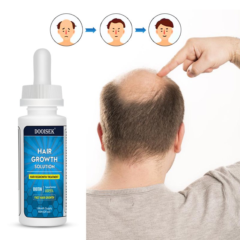 Fast Hair Growth Product Hair Growth Serum Tonic 60ml DOOISEK 5% Hair Growth Oil with dropper