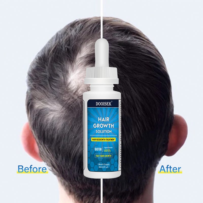 Fast Hair Growth Product Hair Growth Serum Tonic 60ml DOOISEK 5% Hair Growth Oil with dropper