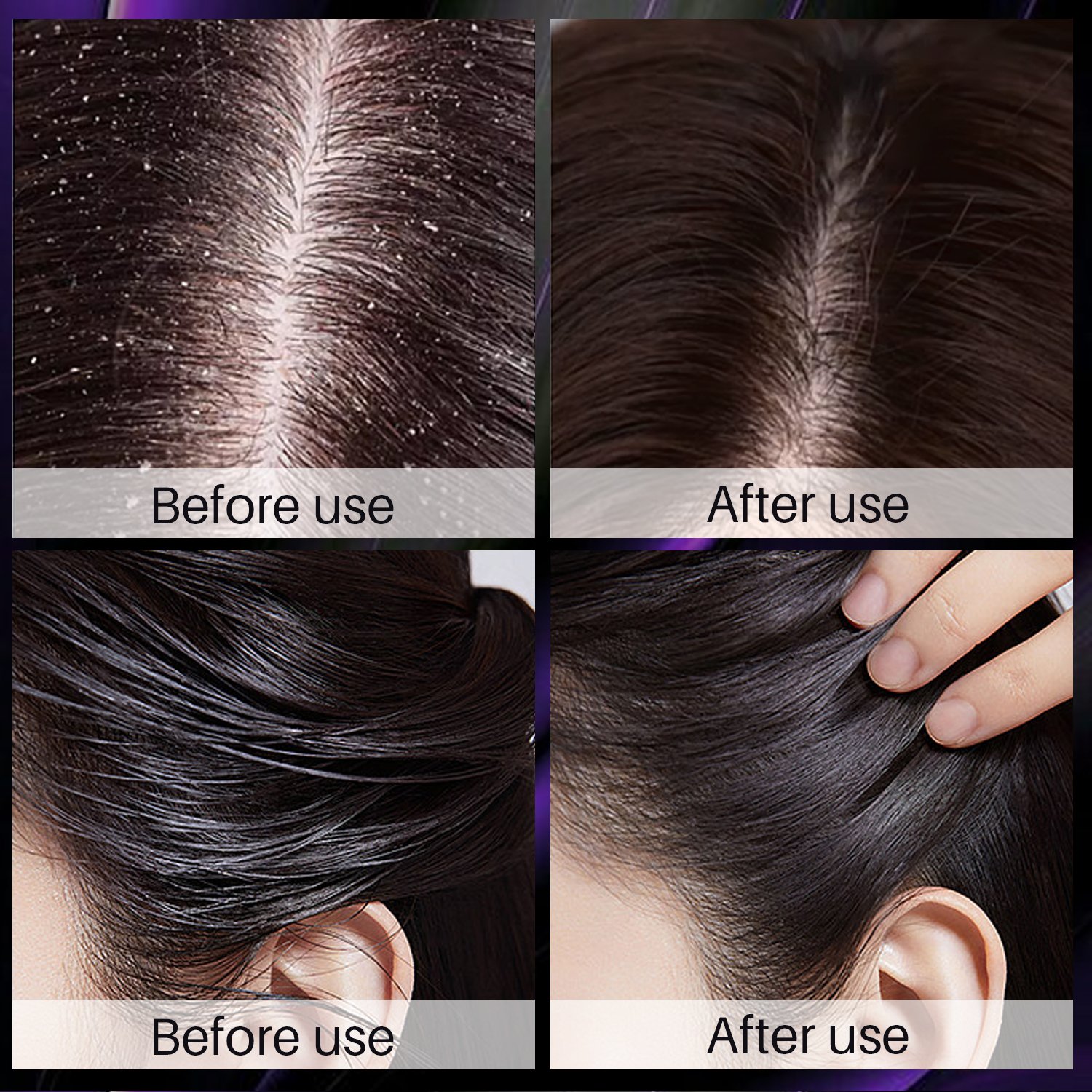 Mint Strengthening Shampoo Anti Hair Loss Treatment Organic Repair Bulk Onion Rosemary shampoo Onion Shampoo 500Ml And OEM