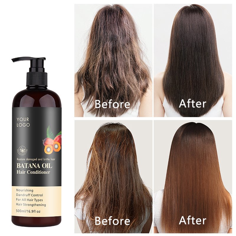 Private Label Rosemary Anit-Hair Loss Shampoo Hair Growth Batana Oil Regrowth Hair Shampoo Set for scalp health
