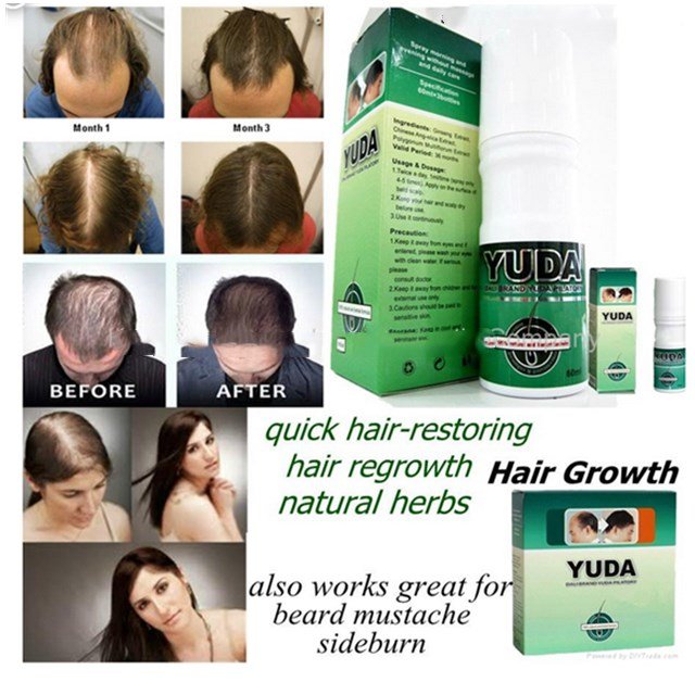 Favorite hair tonic anti hair loss hair growth stimulator YUDA pilatory or private label