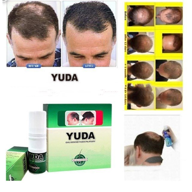 Favorite hair tonic anti hair loss hair growth stimulator YUDA pilatory or private label