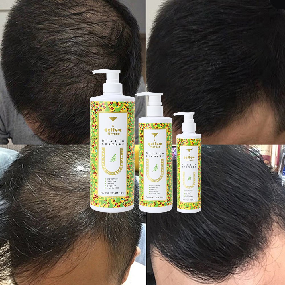 OEM ODM Silicone Free Soothes Scalp Keratin Hair Growth Thickening Biotin Shampoo for hair growth
