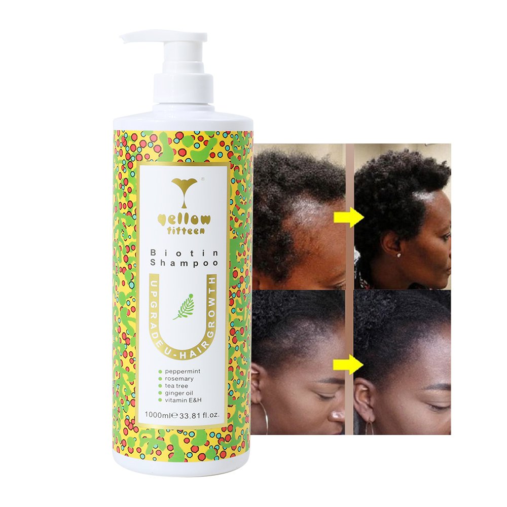 OEM ODM Silicone Free Soothes Scalp Keratin Hair Growth Thickening Biotin Shampoo for hair growth